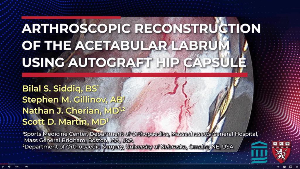 Hip Labral Repair Technique