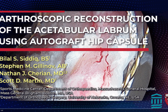 Hip Labral Repair Technique